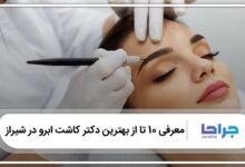 بهترین دکتر کاشت ابرو در شیراز