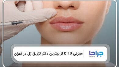 بهترین دکتر تزریق ژل در تهران