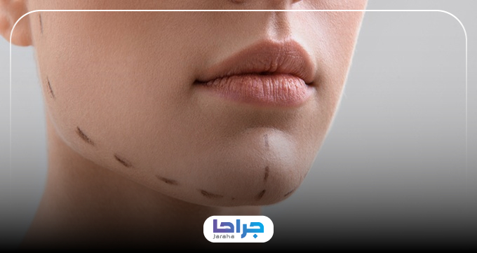هزینه پروتز فک چقدر می باشد؟