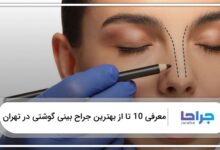 بهترین جراح بینی گوشتی در تهران