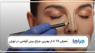 بهترین جراح بینی گوشتی در تهران