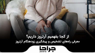 از کجا بفهمیم آرتروز داریم؟