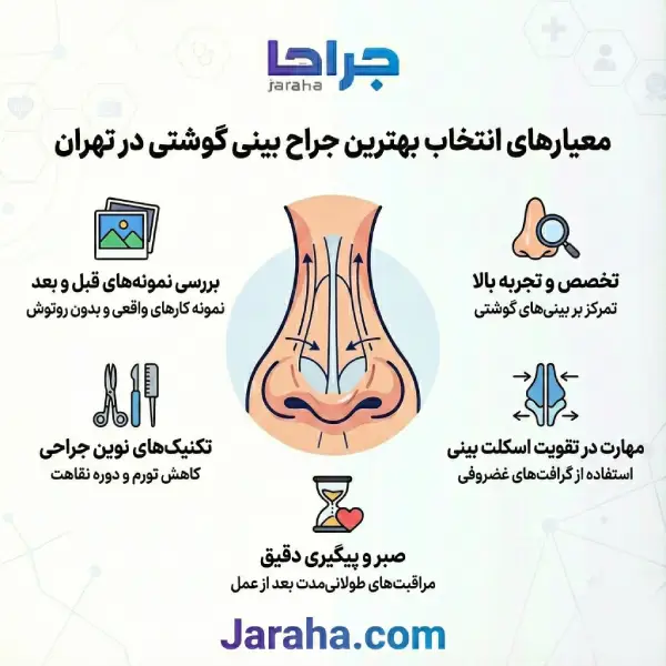 معیارهای انتخاب بهترین جراح بینی گوشتی در تهران از نظر وبسایت جراحا
