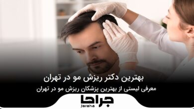 بهترین دکتر ریزش مو در تهران