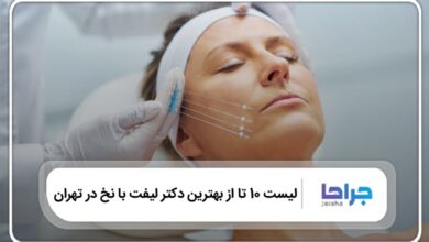 بهترین دکتر لیفت با نخ در تهران