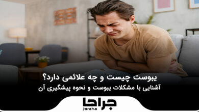 یبوست چیست و چه علائمی دارد؟