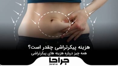 هزینه پیکرتراشی چقدر است