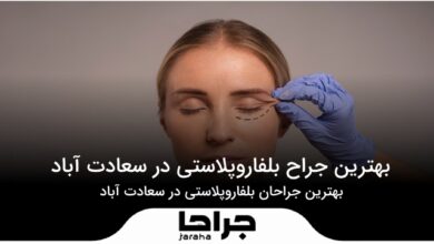 بهترین جراح بلفاروپلاستی در سعادت آباد