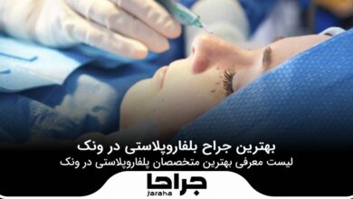 بهترین جراح بلفاروپلاستی در ونک