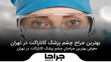بهترین جراح چشم پزشک کاتاراکت در تهران