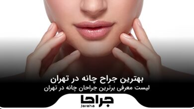 بهترین جراح چانه در تهران