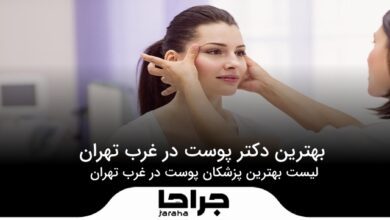 بهترین دکتر پوست در غرب تهران
