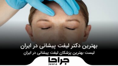 بهترین دکتر لیفت پیشانی در ایران