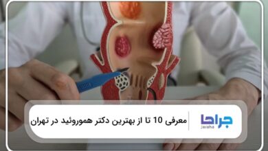 بهترین دکتر هموروئید در تهران