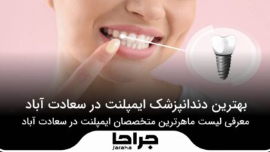بهترین دندانپزشک ایمپلنت در سعادت آباد