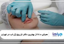 بهترین دکتر تزریق ژل لب در تهران