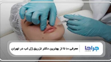 بهترین دکتر تزریق ژل لب در تهران