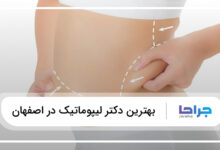 بهترین دکتر لیپوماتیک در اصفهان