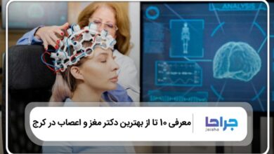 بهترین دکتر مغز و اعصاب در کرج