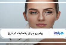 بهترین جراح پلاستیک در کرج