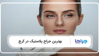 بهترین جراح پلاستیک در کرج