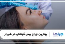 بهترین جراح بینی گوشتی در شیراز