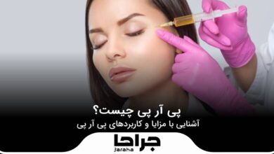 پی آر پی چیست
