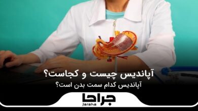 آپاندیس چیست و کجاست؟