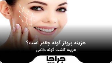 هزینه پروتز گونه چقدر است؟