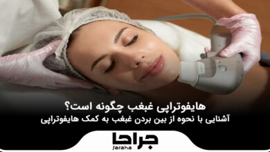 هایفوتراپی غبغب چگونه است؟