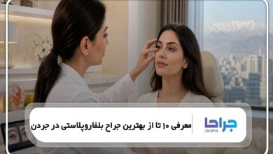 معرفی 10 تا از بهترین جراح بلفاروپلاستی در جردن❤️【سال1405】⭐