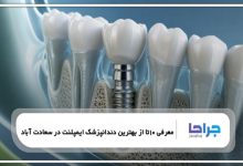 10 تا از بهترین دندانپزشک ایمپلنت در سعادت آباد【سال1405】❤️