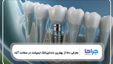 10 تا از بهترین دندانپزشک ایمپلنت در سعادت آباد【سال1405】❤️