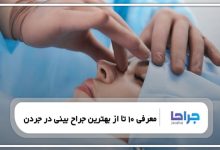 معرفی 10 تا از بهترین جراح بینی در جردن【سال1405】❤️