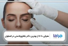بهترین دکتر بلفاروپلاستی در اصفهان