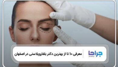بهترین دکتر بلفاروپلاستی در اصفهان