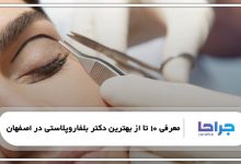 بهترین دکتر بلفاروپلاستی در اصفهان