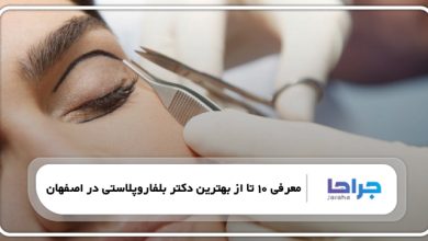 بهترین دکتر بلفاروپلاستی در اصفهان