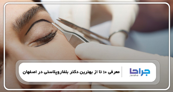 بهترین دکتر بلفاروپلاستی در اصفهان