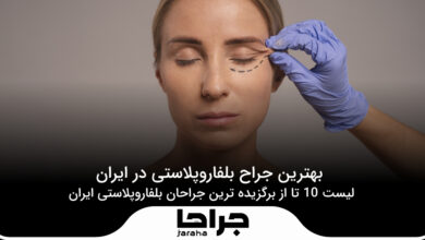 بهترین جراح بلفاروپلاستی در ایران