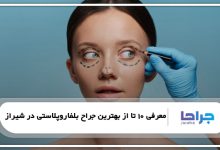 بهترین جراح بلفاروپلاستی در شیراز