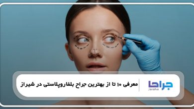 بهترین جراح بلفاروپلاستی در شیراز