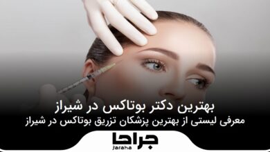 بهترین دکتر بوتاکس در شیراز