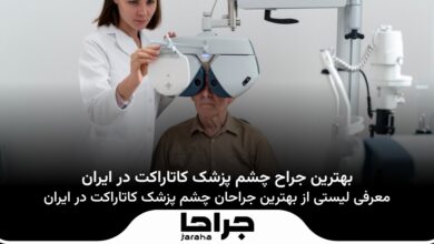 بهترین جراح کاتاراکت در ایران