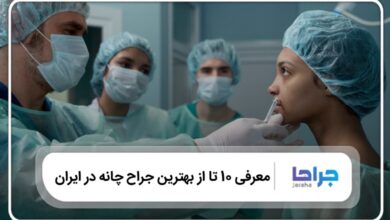 10 تا از بهترین جراح چانه در ایران