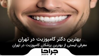 بهترین دکتر کامپوزیت در تهران