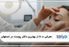 بهترین دکتر پوست در اصفهان