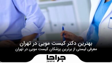 بهترین دکتر کیست مویی در تهران