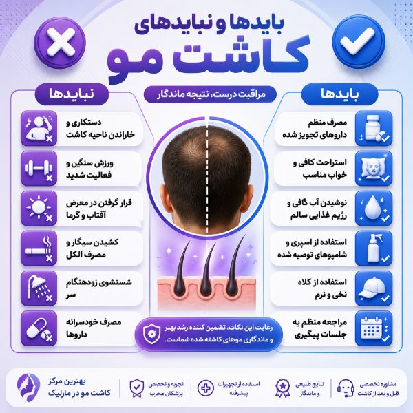باید ها و نباید های کاشت مو