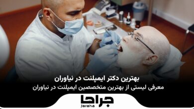 بهترین دکترایمپلنت در نیاوران